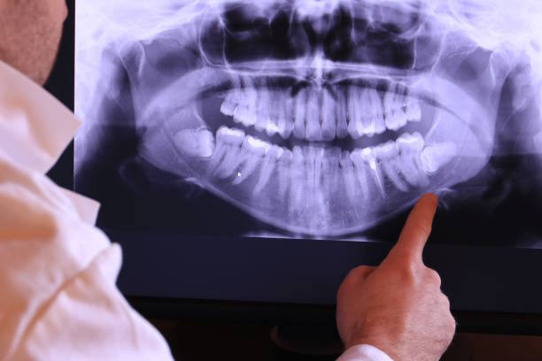 Best Weekend Emergency Dentist in Ferndale, PA