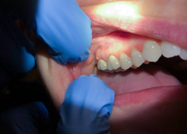 Best Weekend Emergency Dentist in Ferndale, PA
