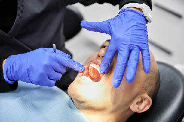 Best Broken or Cracked Tooth Emergency Dentist in Ferndale, PA